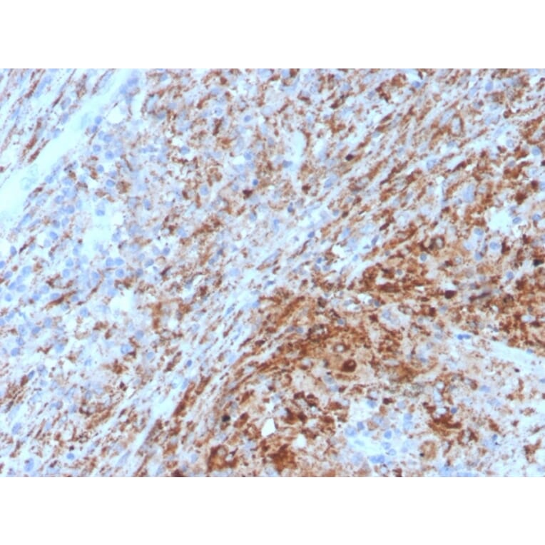 Immunohistochemistry - Anti-TIM3 Antibody [TIM3/4029] (A250425) - Antibodies.com