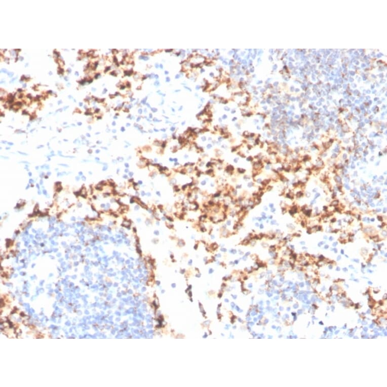 Immunohistochemistry - Anti-TIM3 Antibody [TIM3/4029] (A250425) - Antibodies.com