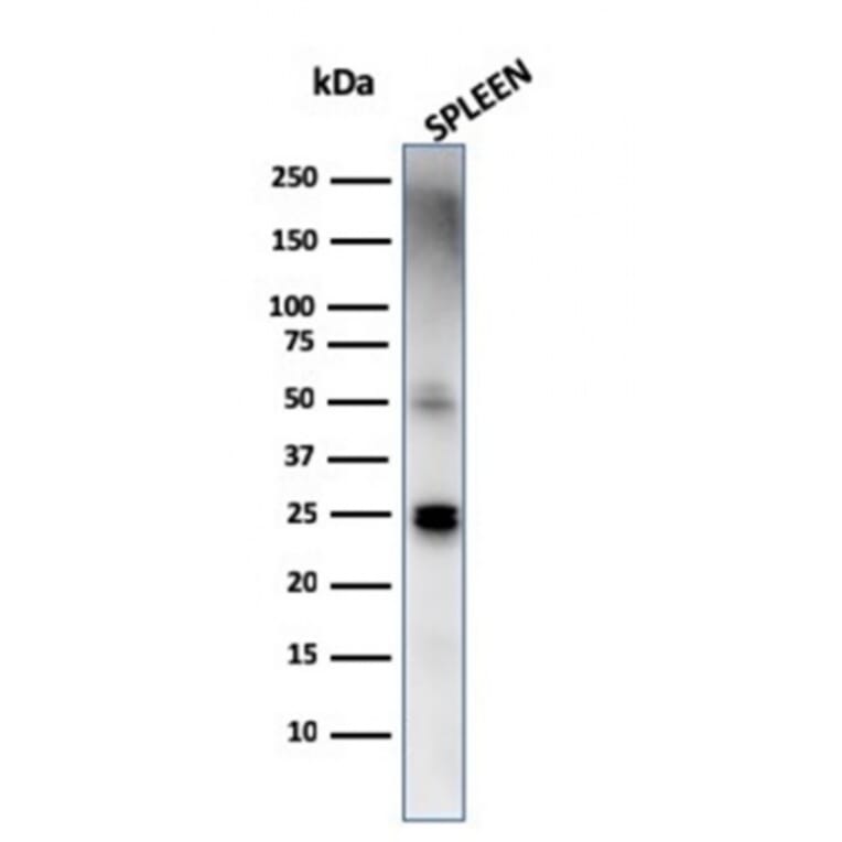 Western Blot - Anti-TIM3 Antibody [TIM3/4029] (A250425) - Antibodies.com