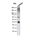 Western Blot - Anti-TIM3 Antibody [TIM3/4029] (A250425) - Antibodies.com