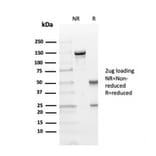SDS-PAGE - Anti-TIM3 Antibody [TIM3/4029] (A250425) - Antibodies.com