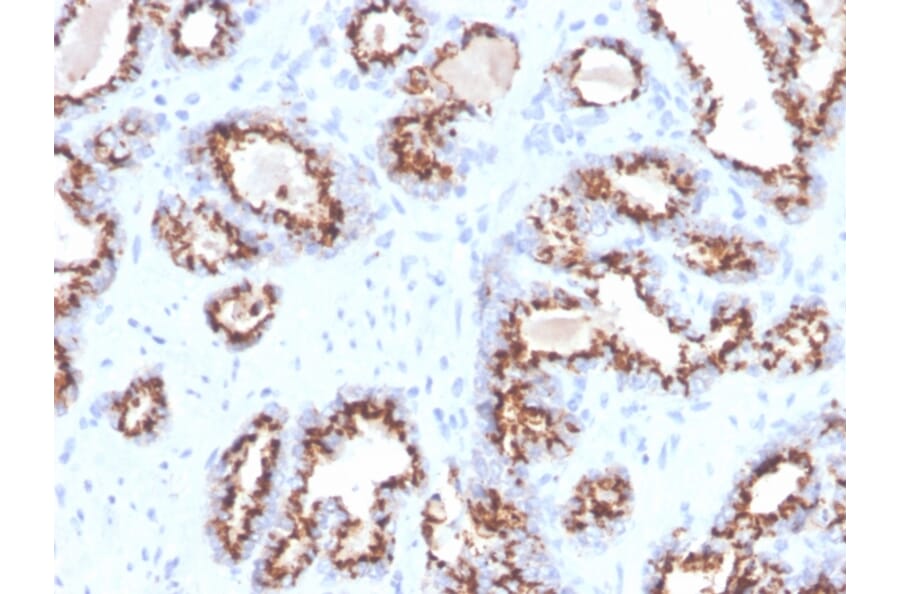Immunohistochemistry - Anti-Prostein Antibody [ZR9] (A250426) - Antibodies.com