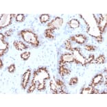 Immunohistochemistry - Anti-Prostein Antibody [ZR9] (A250426) - Antibodies.com