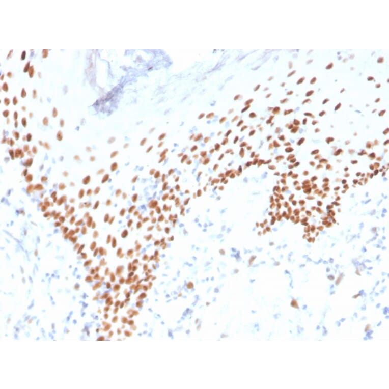 Immunohistochemistry - Anti-p40 Antibody [rTP40/3690] (A250427) - Antibodies.com