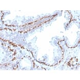 Immunohistochemistry - Anti-p40 Antibody [rTP40/3690] (A250427) - Antibodies.com