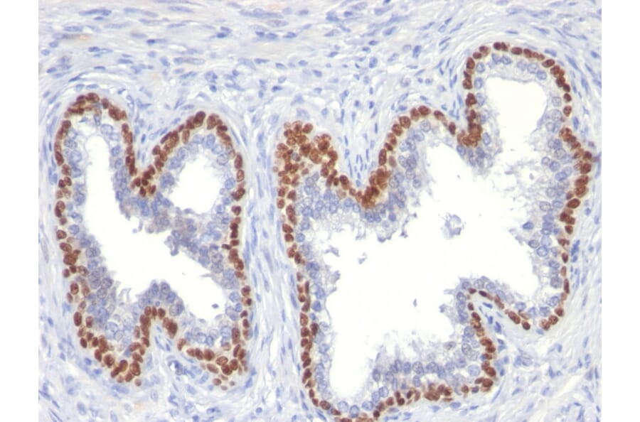 Immunohistochemistry - Anti-p63 Antibody [TP63/11] (A250427) - Antibodies.com