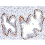 Immunohistochemistry - Anti-p63 Antibody [TP63/11] (A250427) - Antibodies.com