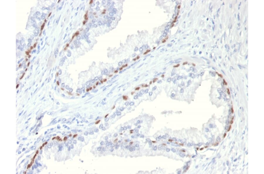 Immunohistochemistry - Anti-p63 Antibody [TP63/11] (A250428) - Antibodies.com