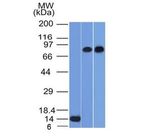 Western Blot - Anti-p63 Antibody [TP63/1786] (A250429) - Antibodies.com