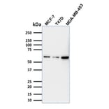 Western Blot - Anti-p63 Antibody [TP63/1786] (A250429) - Antibodies.com