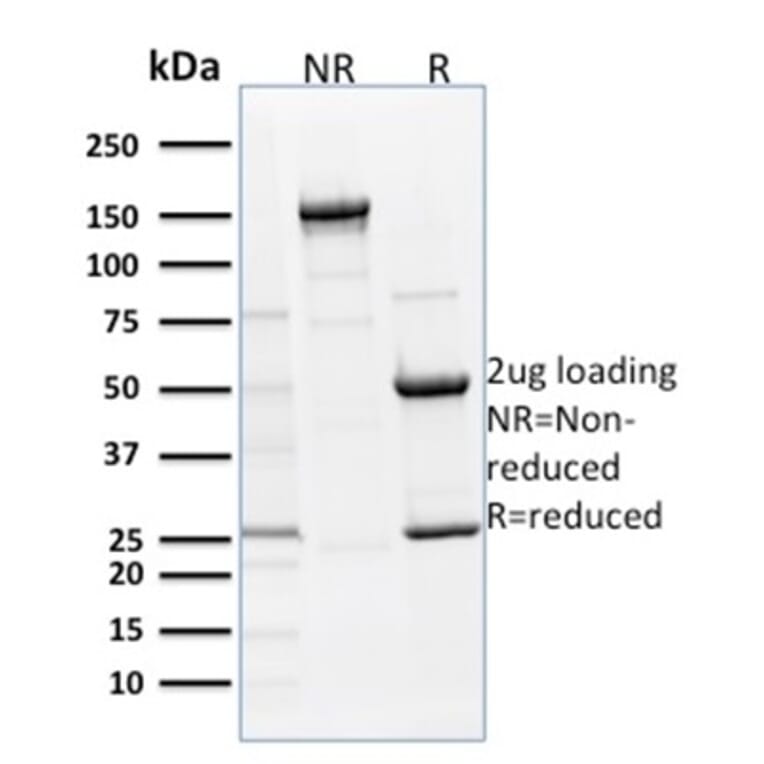 SDS-PAGE - Anti-p63 Antibody [TP63/1786] (A250429) - Antibodies.com