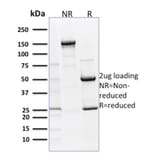 SDS-PAGE - Anti-p63 Antibody [TP63/1786] (A250429) - Antibodies.com