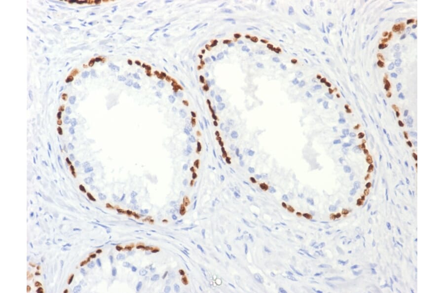 Immunohistochemistry - Anti-p63 Antibody [TP63/2427] (A250430) - Antibodies.com