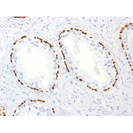 Immunohistochemistry - Anti-p63 Antibody [TP63/2427] (A250430) - Antibodies.com