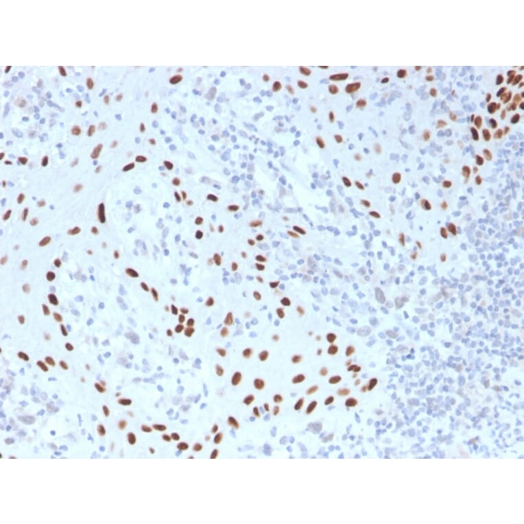 Immunohistochemistry - Anti-p40 Antibody [TP40/3980R] (A250432) - Antibodies.com