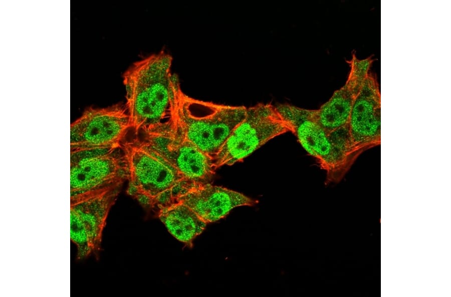 Immunofluorescence - Anti-p40 Antibody [TP40/3980R] (A250432) - Antibodies.com