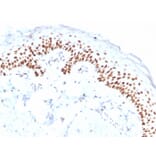 Immunohistochemistry - Anti-p40 Antibody [ZR8] (A250433) - Antibodies.com