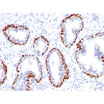 Immunohistochemistry - Anti-p63 Antibody [TP63/1423R] (A250433) - Antibodies.com