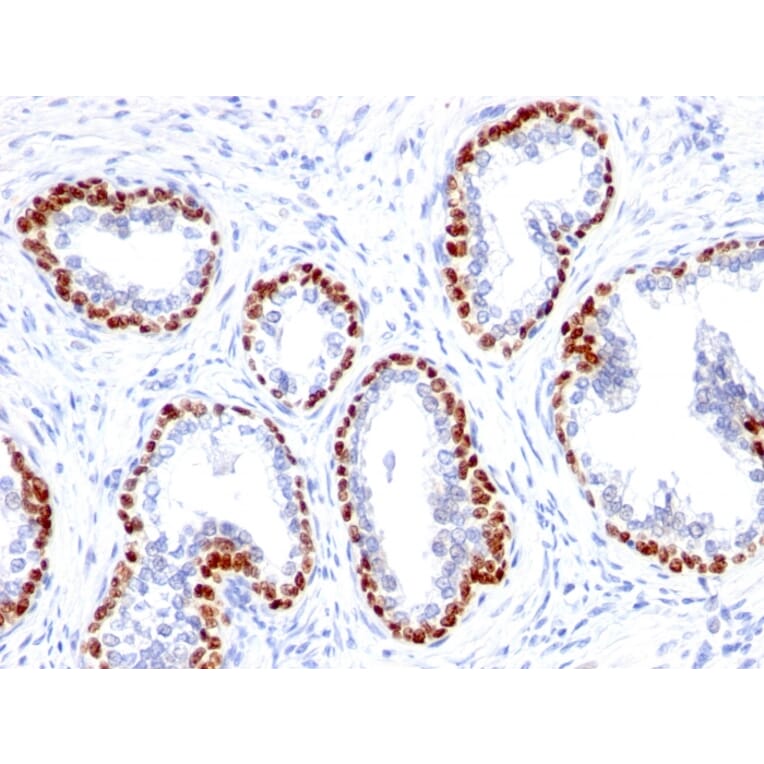 Immunohistochemistry - Anti-p63 Antibody [TP63/1423R] (A250433) - Antibodies.com