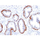 Immunohistochemistry - Anti-p63 Antibody [TP63/1423R] (A250433) - Antibodies.com
