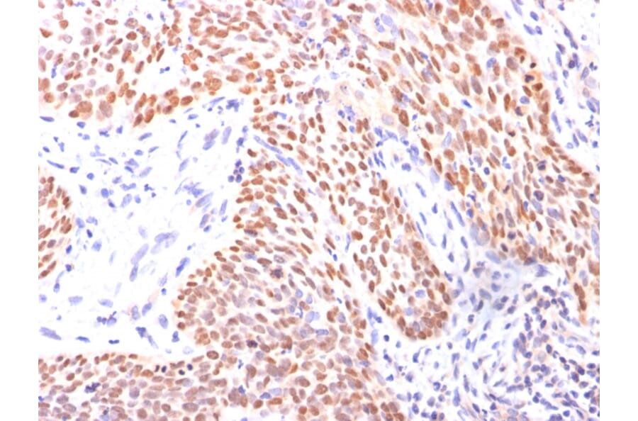 Immunohistochemistry - Anti-p40 Antibody (A250435) - Antibodies.com
