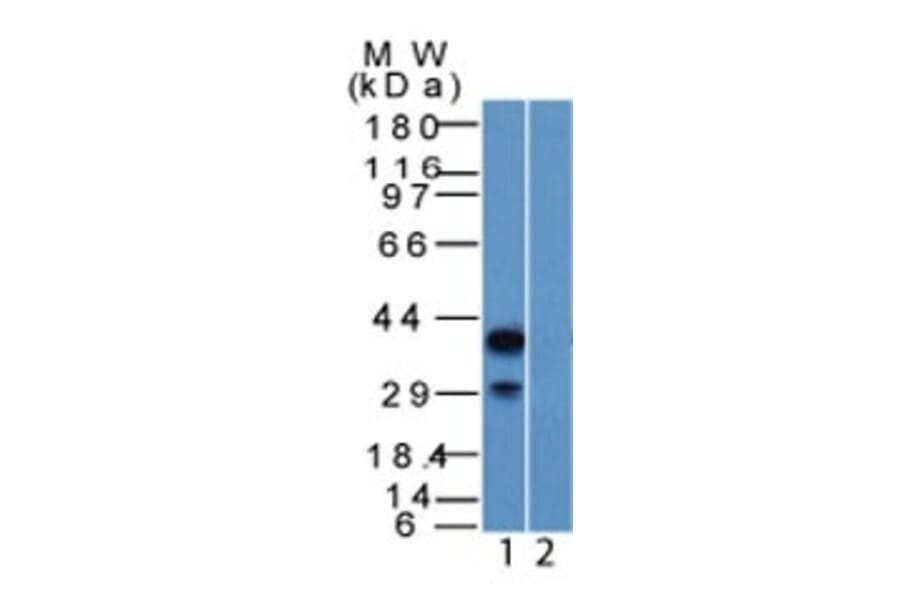 Western Blot - Anti-p40 Antibody (A250435) - Antibodies.com