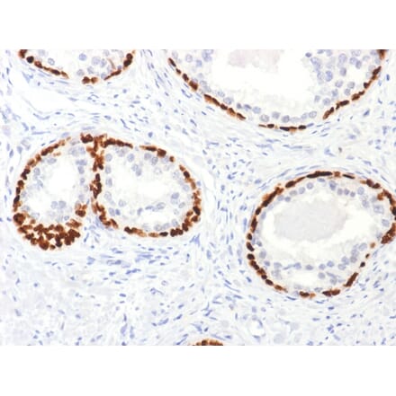Immunohistochemistry - Anti-p63 Antibody (A250435) - Antibodies.com