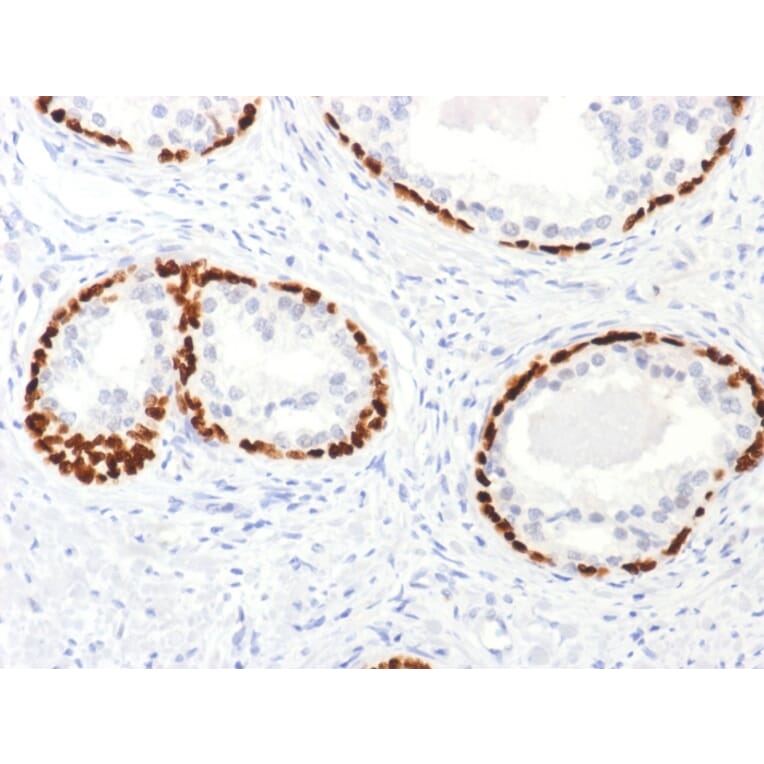 Immunohistochemistry - Anti-p63 Antibody (A250435) - Antibodies.com
