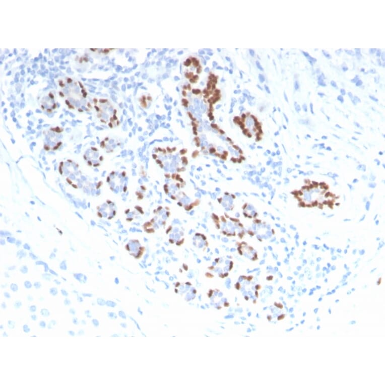 Immunohistochemistry - Anti-p40 Antibody (A250437) - Antibodies.com