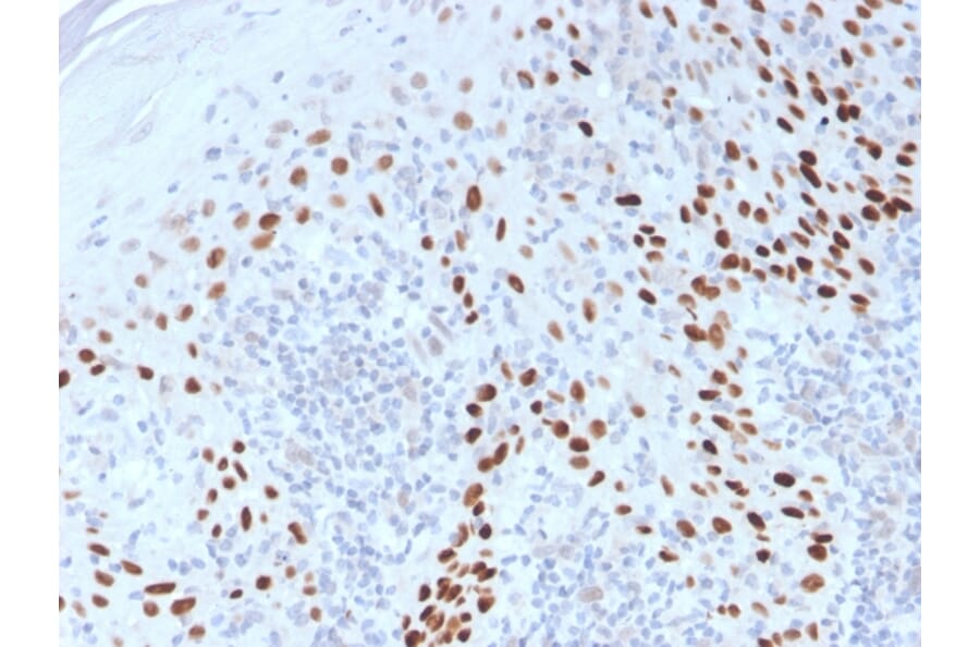 Immunohistochemistry - Anti-p40 Antibody (A250436) - Antibodies.com