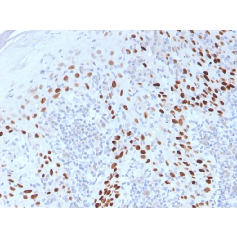 Immunohistochemistry - Anti-p40 Antibody (A250436) - Antibodies.com