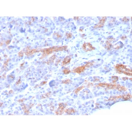 Immunohistochemistry - Anti-MRP3 Antibody [ABCC3/2971] (A250438) - Antibodies.com