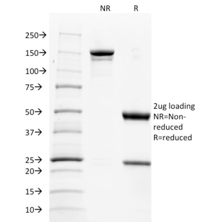 SDS-PAGE - Anti-TNFSF9 Antibody [CD137L/1547] (A250439) - Antibodies.com