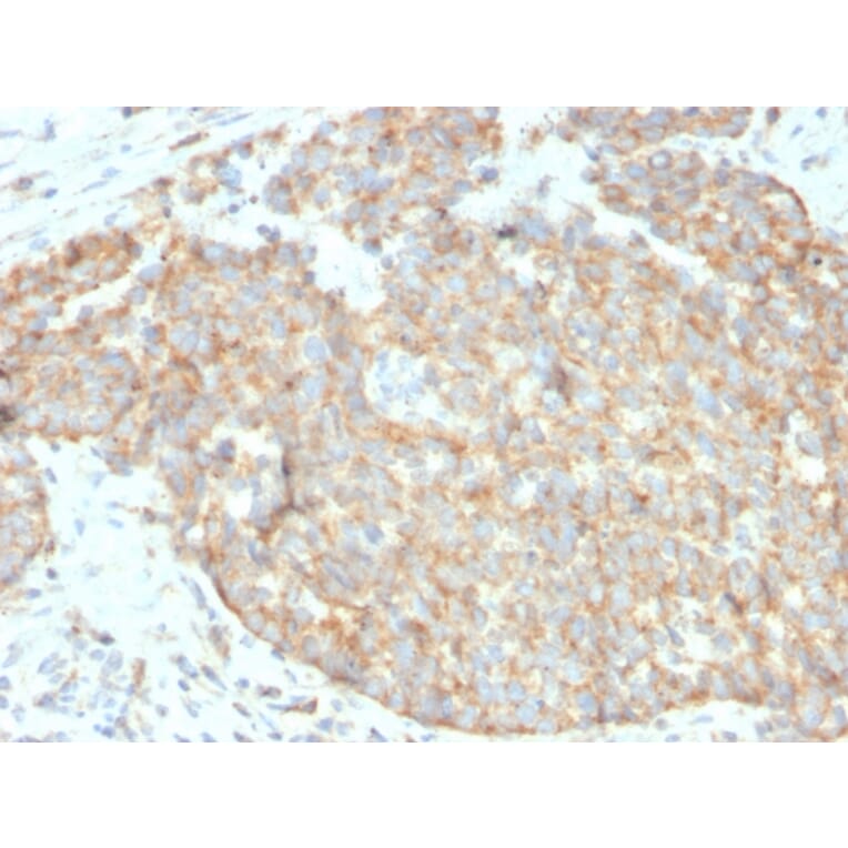 Immunohistochemistry - Anti-CD262 Antibody [DR5/3381] (A250441) - Antibodies.com