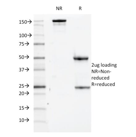 SDS-PAGE - Anti-CD84 Antibody [152-1D5] (A250443) - Antibodies.com