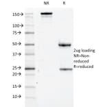 SDS-PAGE - Anti-CD84 Antibody [152-1D5] (A250443) - Antibodies.com