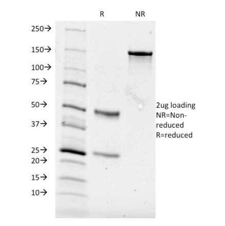 SDS-PAGE - Anti-CD84 Antibody [153-4D9] (A250444) - Antibodies.com