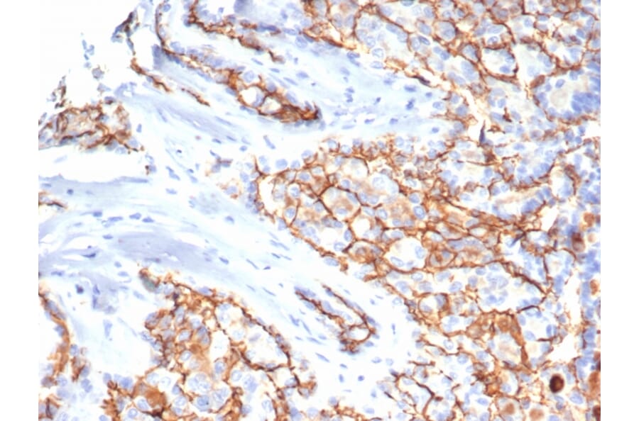 Immunohistochemistry - Anti-CD133 Antibody [HB#7] (A250445) - Antibodies.com