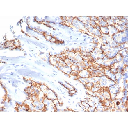 Immunohistochemistry - Anti-CD133 Antibody [HB#7] (A250445) - Antibodies.com