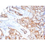 Immunohistochemistry - Anti-CD133 Antibody [HB#7] (A250445) - Antibodies.com