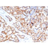 Immunohistochemistry - Anti-CD133 Antibody [HB#7] (A250444) - Antibodies.com