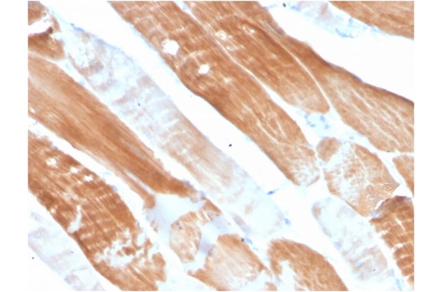 Immunohistochemistry - Anti-Sarcomeric Actinin alpha 2 Antibody [ACTN2/3291] (A250447) - Antibodies.com
