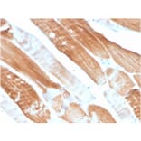 Immunohistochemistry - Anti-Sarcomeric Actinin alpha 2 Antibody [ACTN2/3291] (A250447) - Antibodies.com