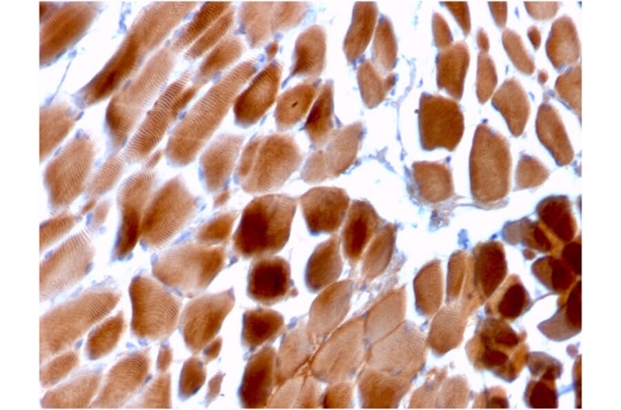 Immunohistochemistry - Anti-Sarcomeric Actinin alpha 2 Antibody [ACTN2/3292] (A250448) - Antibodies.com