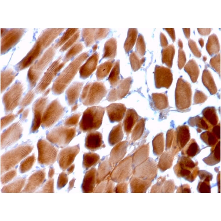Immunohistochemistry - Anti-Sarcomeric Actinin alpha 2 Antibody [ACTN2/3292] (A250448) - Antibodies.com