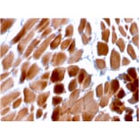 Immunohistochemistry - Anti-Sarcomeric Actinin alpha 2 Antibody [ACTN2/3292] (A250448) - Antibodies.com