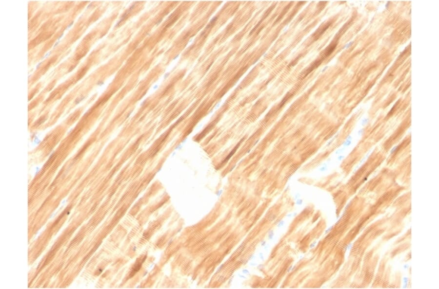 Immunohistochemistry - Anti-Sarcomeric Actinin alpha 2 Antibody [ACTN2/3292] (A250448) - Antibodies.com