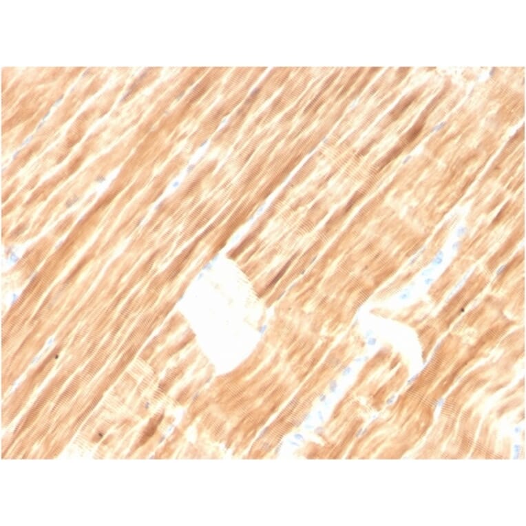 Immunohistochemistry - Anti-Sarcomeric Actinin alpha 2 Antibody [ACTN2/3292] (A250448) - Antibodies.com