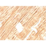 Immunohistochemistry - Anti-Sarcomeric Actinin alpha 2 Antibody [ACTN2/3292] (A250448) - Antibodies.com