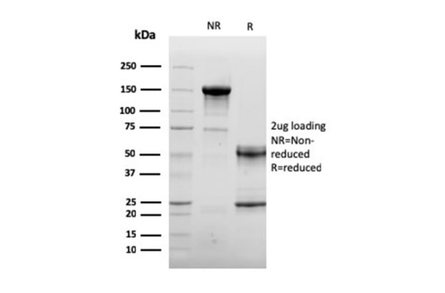 SDS-PAGE - Anti-Sarcomeric Actinin alpha 2 Antibody [ACTN2/3292] (A250448) - Antibodies.com